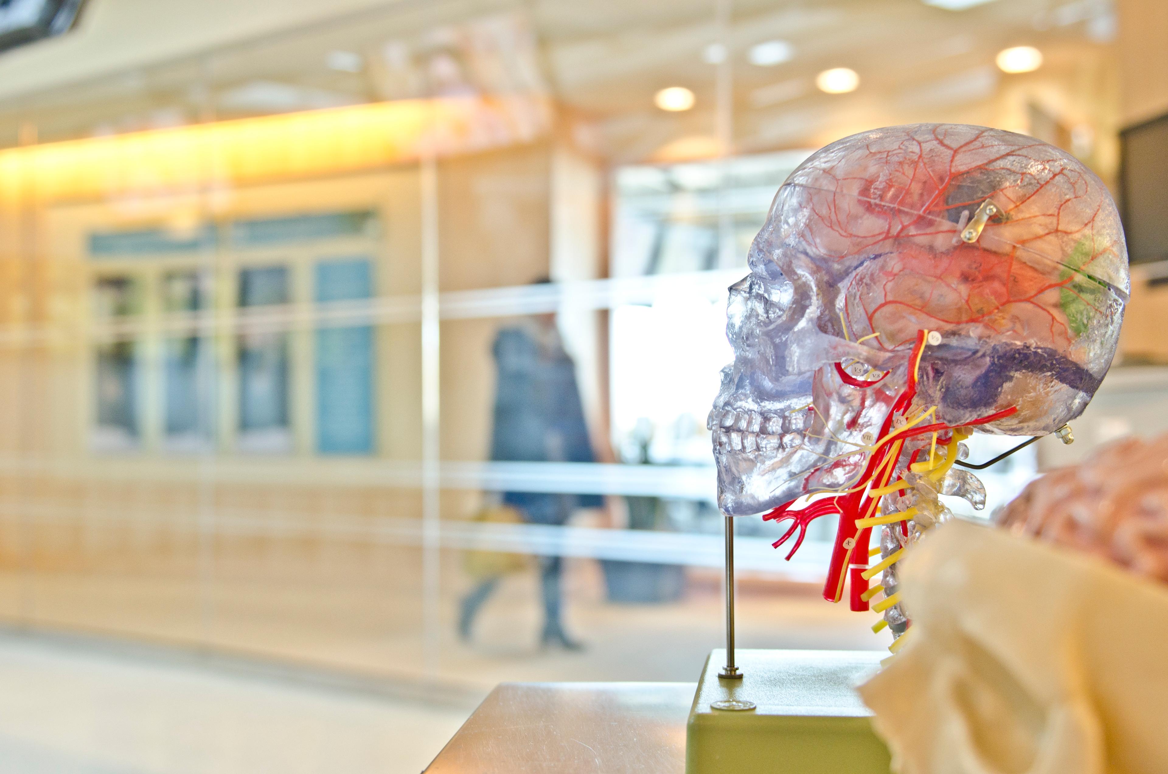 A display of a skull and blood vessels