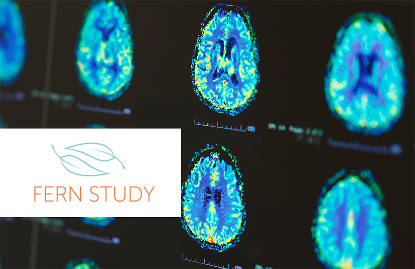 The image displays multiple brain scans, showcasing colorful and intricate patterns that appear to be cross-sections or slices of the brain. The background is dark, providing a stark contrast to the vibrant, multicolored brain images in the foreground.